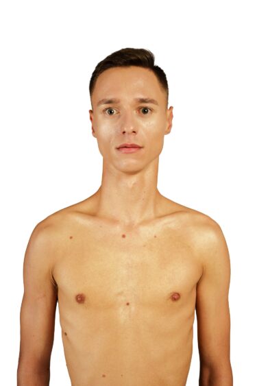 Jakub Ch. 9